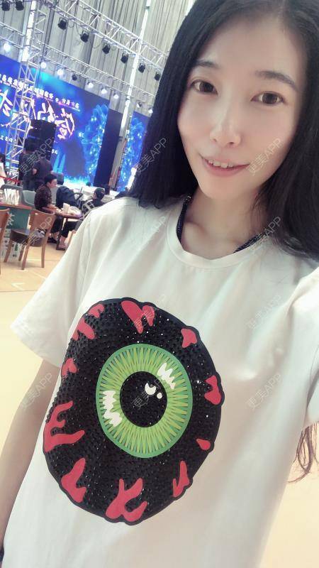 更美 - 摇滚吧姑娘的埋线提升经验 | 埋线除皱 | 昆明 | 埋线提升
