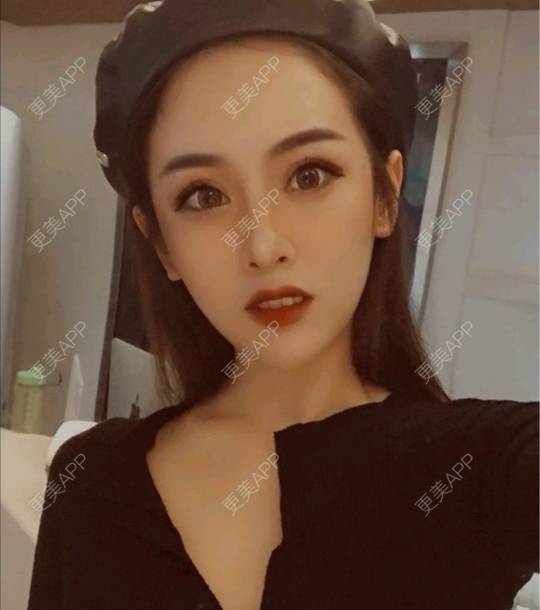 更美 - 更美用户hMQA31WWVx的经验 | 重庆