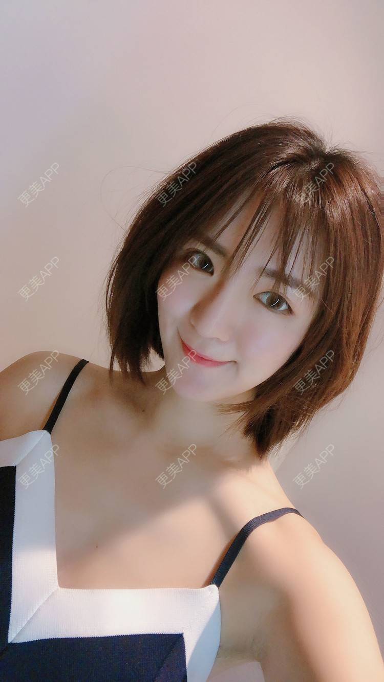 更美 - 华雄伟的激光淡斑经验 | 激光淡斑 | 武汉