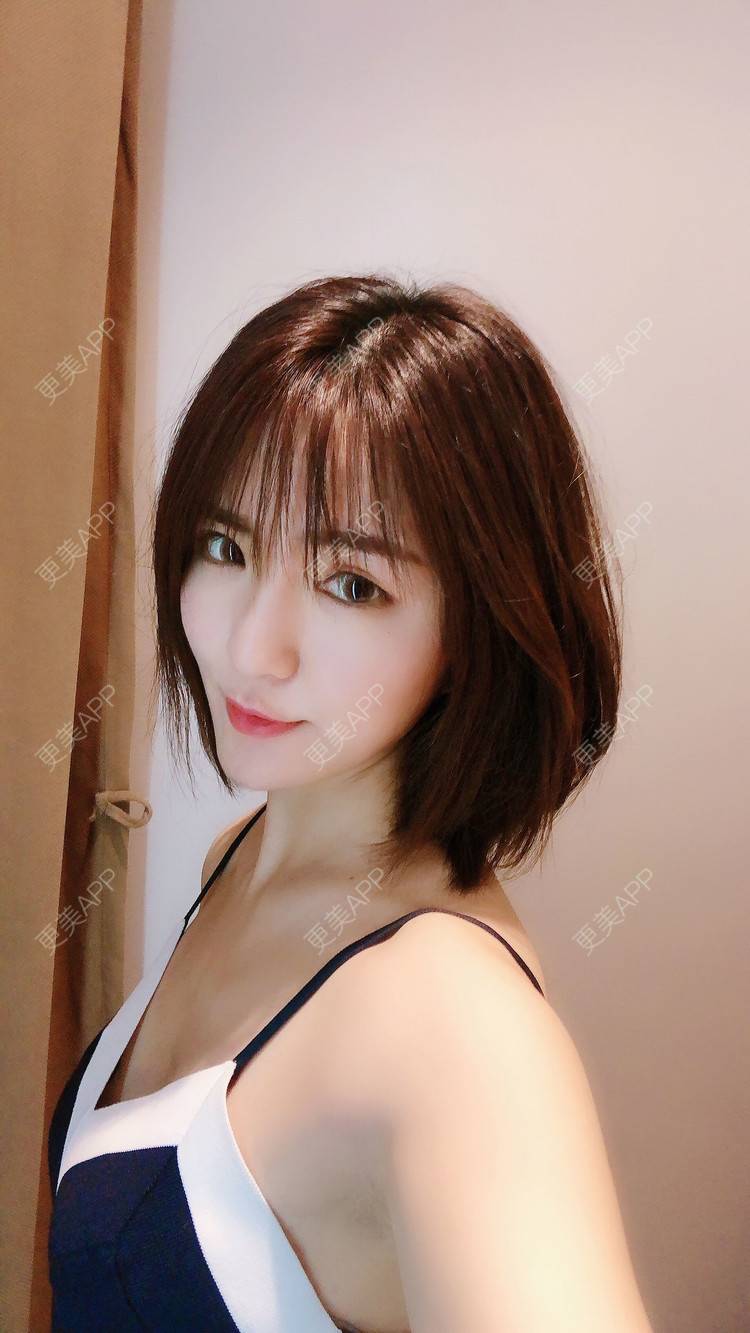 更美 - 华雄伟的激光淡斑经验 | 激光淡斑 | 武汉