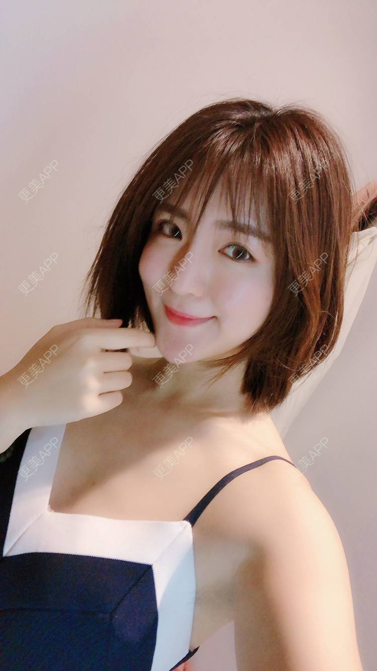 更美 - 华雄伟的激光淡斑经验 | 激光淡斑 | 武汉