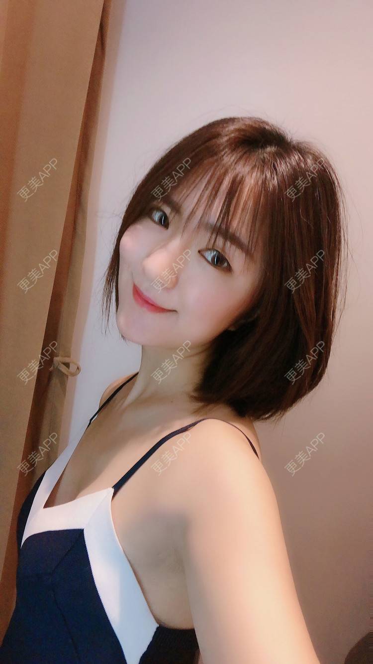 更美 - 华雄伟的激光淡斑经验 | 激光淡斑 | 武汉