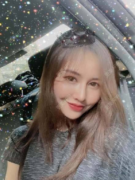 更美 - 少女般温柔~的厚唇改薄经验 | 厚唇改薄 | 武汉