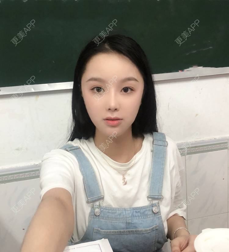 更美 - 预言又止的痛衔的注射淡疤经验 | 注射淡疤 | 激光淡疤 | 成都