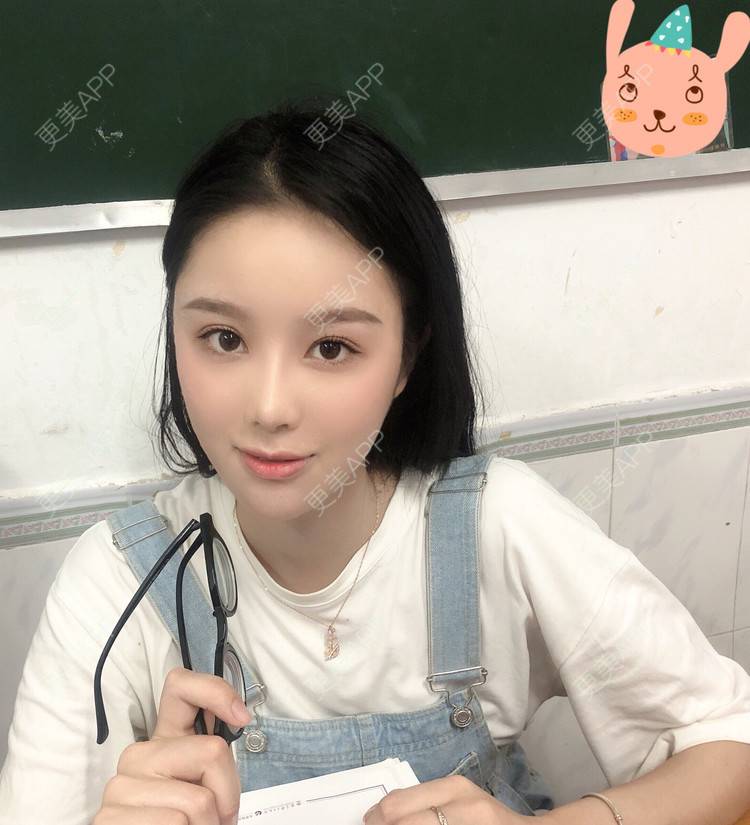 更美 - 预言又止的痛衔的注射淡疤经验 | 注射淡疤 | 激光淡疤 | 成都