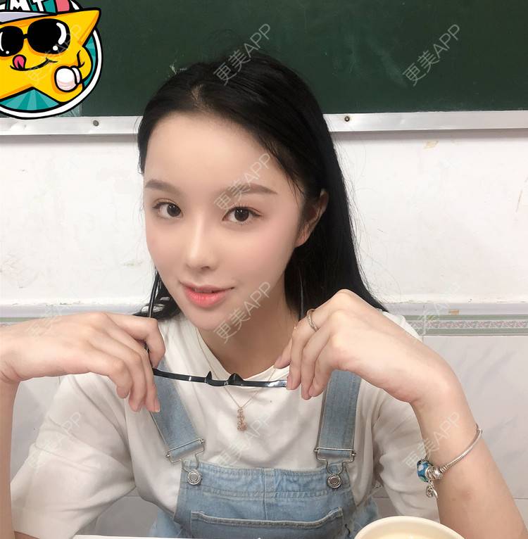 更美 - 预言又止的痛衔的注射淡疤经验 | 注射淡疤 | 激光淡疤 | 成都