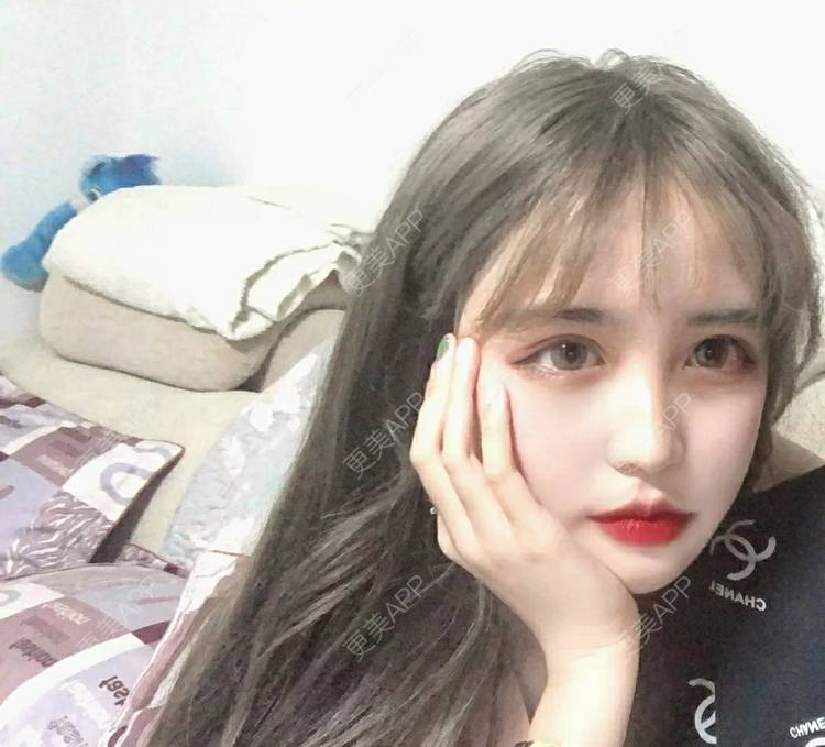 更美 - 更美用户OfX8obHDDF的双眼皮经验 | 双眼皮修复 | 更美研究所 | 双眼皮 | 上海