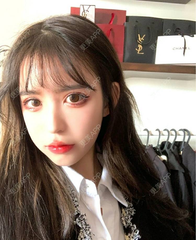 更美 - 更美用户OfX8obHDDF的双眼皮经验 | 双眼皮修复 | 更美研究所 | 双眼皮 | 上海