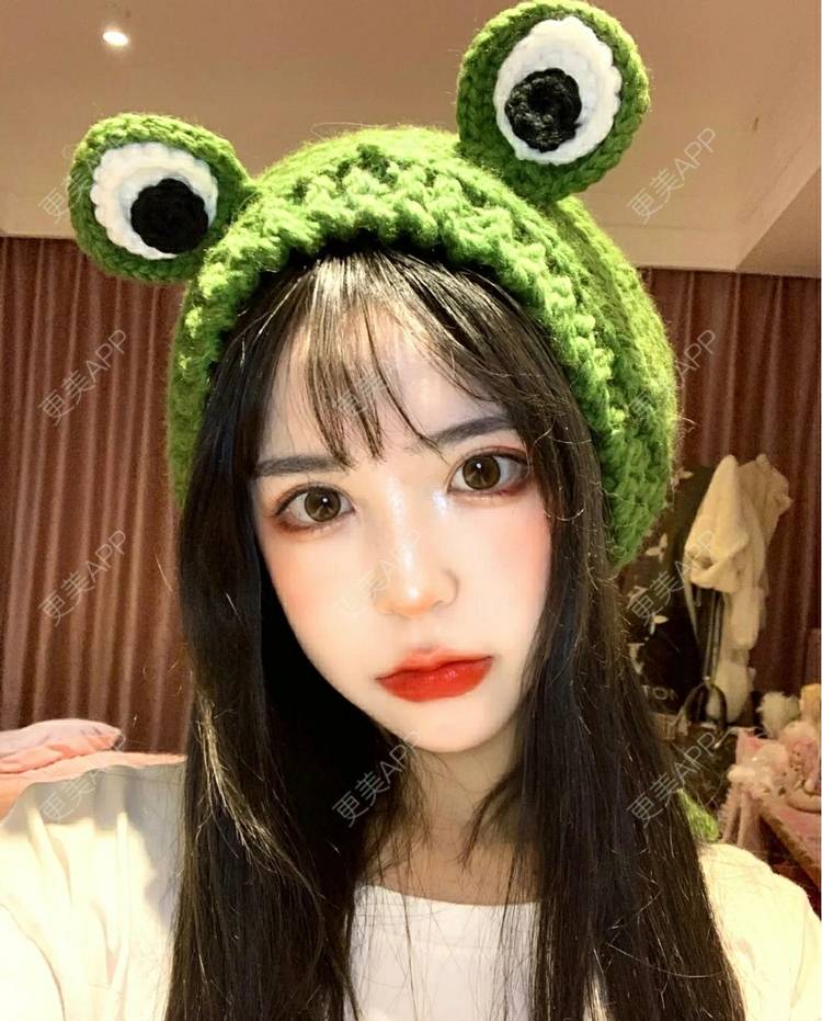 更美 - 更美用户OfX8obHDDF的双眼皮经验 | 双眼皮修复 | 更美研究所 | 双眼皮 | 上海