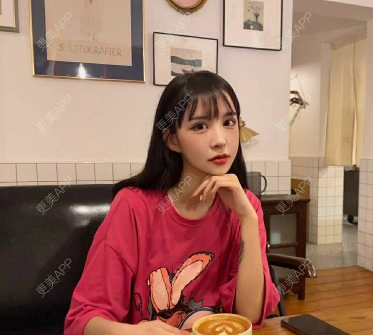 更美 - 更美用户OfX8obHDDF的双眼皮经验 | 双眼皮修复 | 更美研究所 | 双眼皮 | 上海