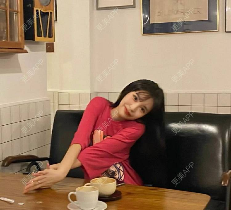 更美 - 更美用户OfX8obHDDF的双眼皮经验 | 双眼皮修复 | 更美研究所 | 双眼皮 | 上海