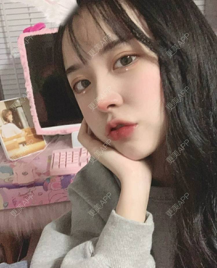 更美 - 更美用户OfX8obHDDF的双眼皮经验 | 双眼皮修复 | 更美研究所 | 双眼皮 | 上海