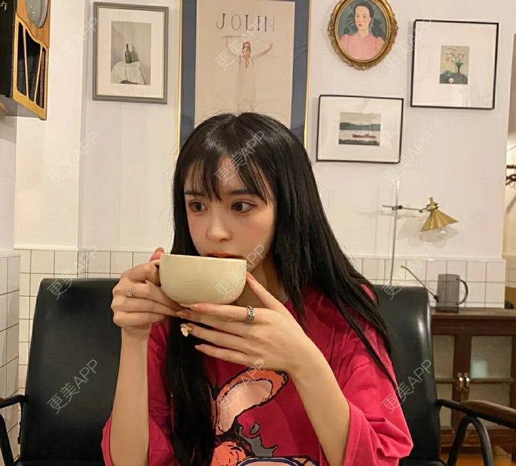 更美 - 更美用户OfX8obHDDF的双眼皮经验 | 双眼皮修复 | 更美研究所 | 双眼皮 | 上海