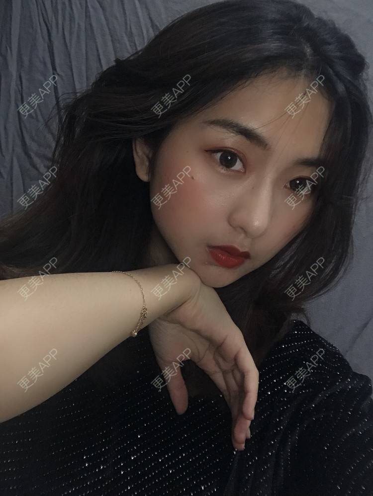 更美 - 更美用户h6811W70iO的鼻翼缩小经验 | 鼻翼缩小 | 福州 | 人工骨隆鼻 | 真皮隆鼻 | 长鼻矫正 | 微晶瓷隆鼻