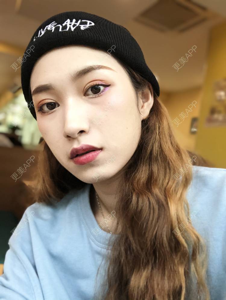 更美 - coollol的鼻部多项经验 | 鼻部多项 | 玻尿酸鼻部 | 肋软骨隆鼻 | 胶原蛋白隆鼻 | 埋线隆鼻 | 自体肋软骨垫鼻基底 | 成都