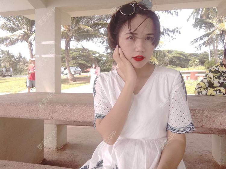 更美 - 更美用户R6xSXj7DGy的埋线提升经验 | 埋线提升 | 广州