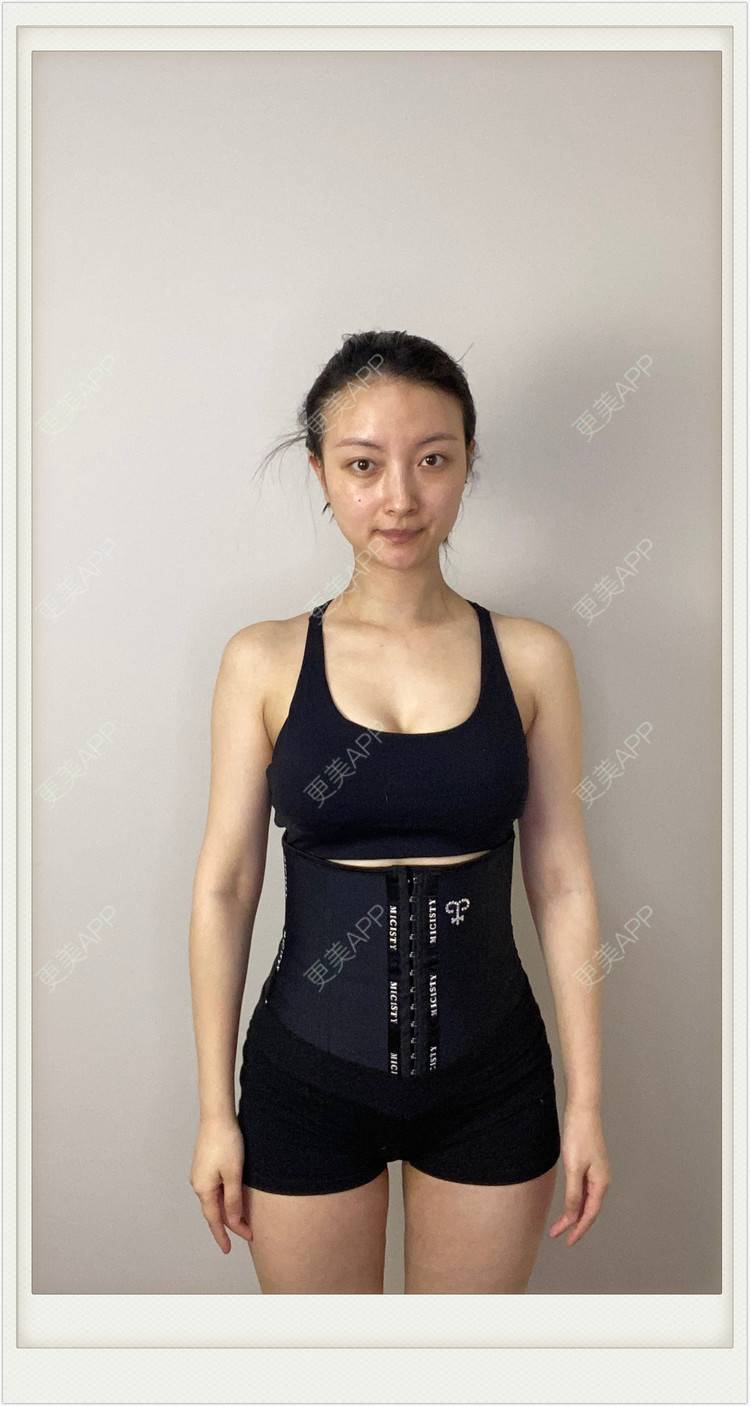 更美 - 不説感情事羌的吸脂经验 | 吸脂 | 无锡