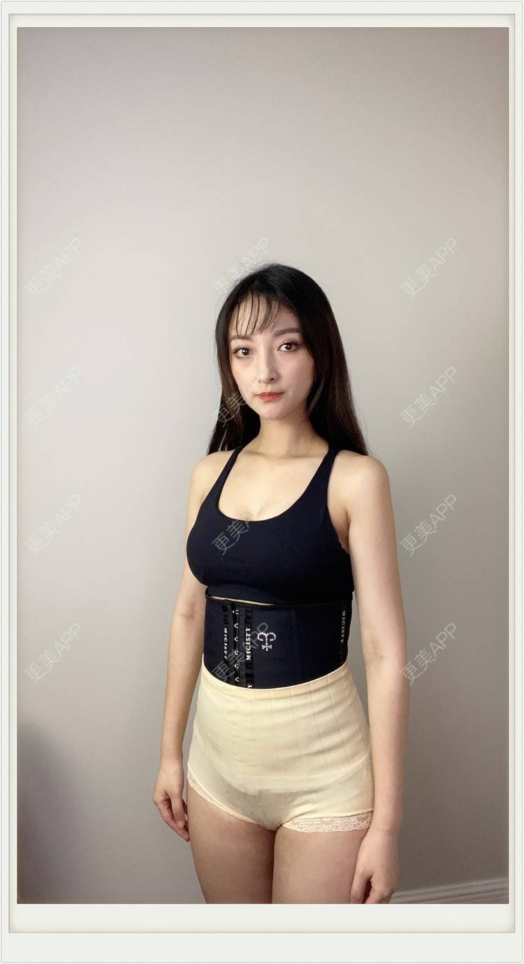 更美 - 不説感情事羌的吸脂经验 | 吸脂 | 无锡