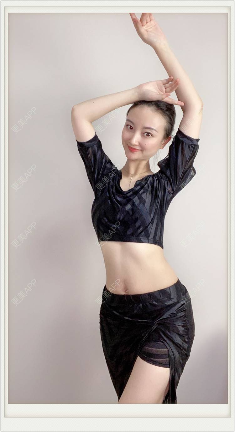 更美 - 不説感情事羌的吸脂经验 | 吸脂 | 无锡