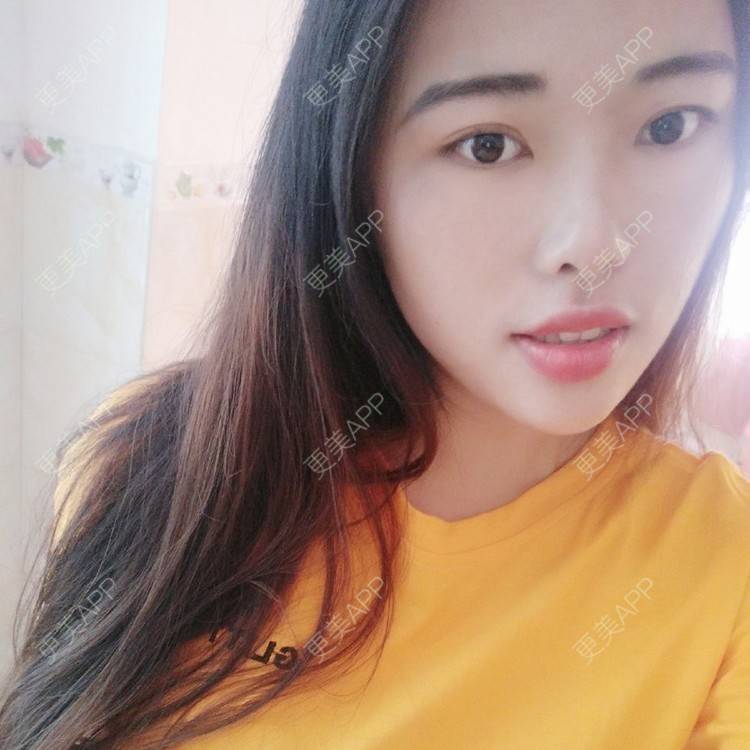 更美 - 深圳华厦眼科医院的ICL晶体植入经验 | ICL晶体植入