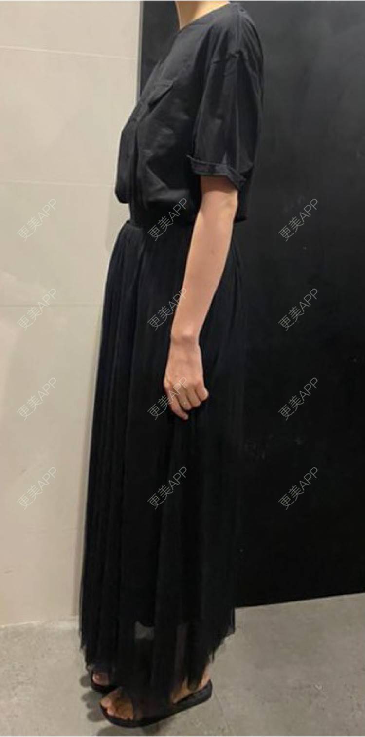 更美 - 玉琼#的自体脂肪丰臀经验 | 自体脂肪丰臀 | 上海