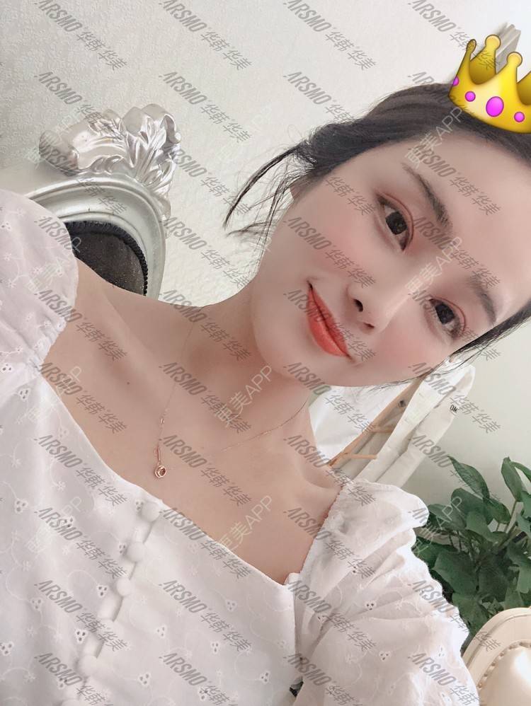 更美 - 在你眼里起风的除皱经验 | 除皱 | 埋线提升 | 埋线除皱 | 除皱套餐 | 长沙