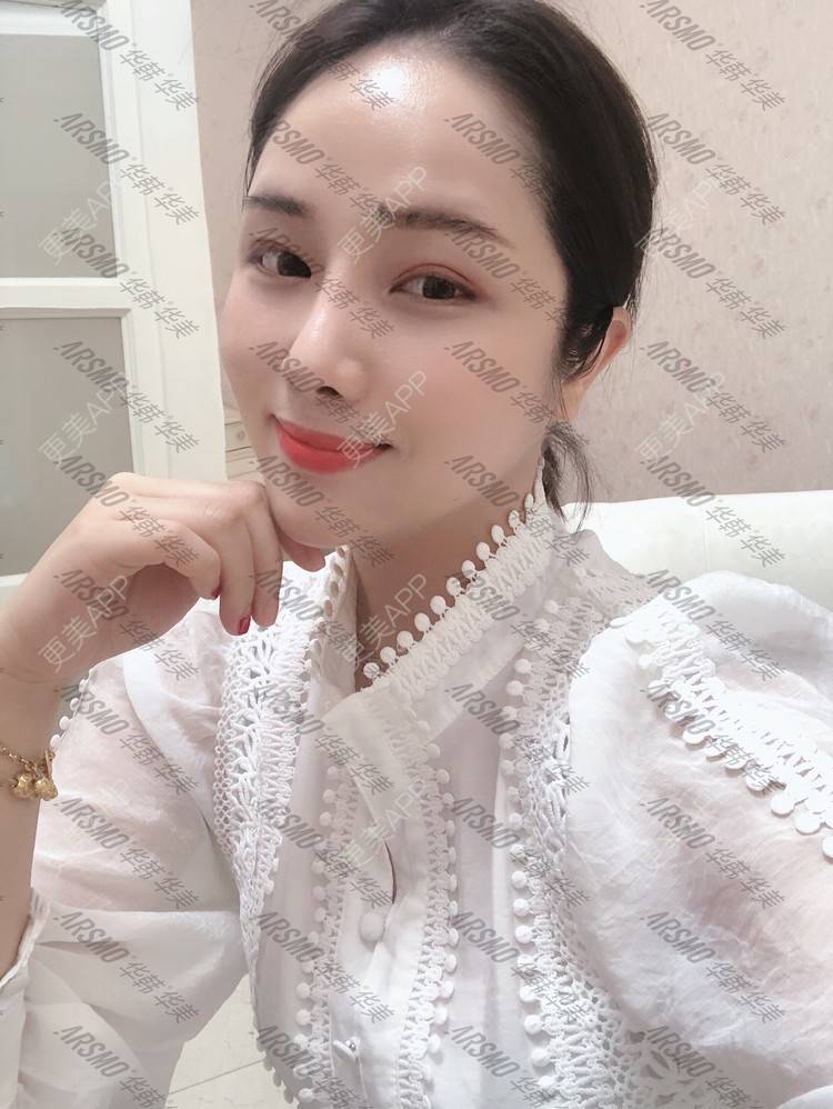 更美 - 在你眼里起风的除皱经验 | 除皱 | 埋线提升 | 埋线除皱 | 除皱套餐 | 长沙