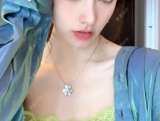 更美 - 牙齿不好看的玻尿酸苹果肌经验 | 更美研究所 | 玻尿酸苹果肌 | 杭州 | 玻尿酸