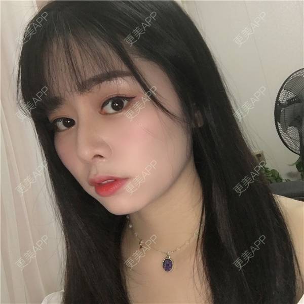 更美 - 更美用户TbWlVCTzIT的手术缩鼻头经验 | 视频日记 | 重庆 | 手术缩鼻头 | 鼻翼缩小 | 微晶瓷隆鼻