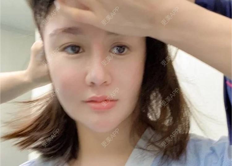 更美 - 66帅气的拉皮经验 | 郑州 | 拉皮