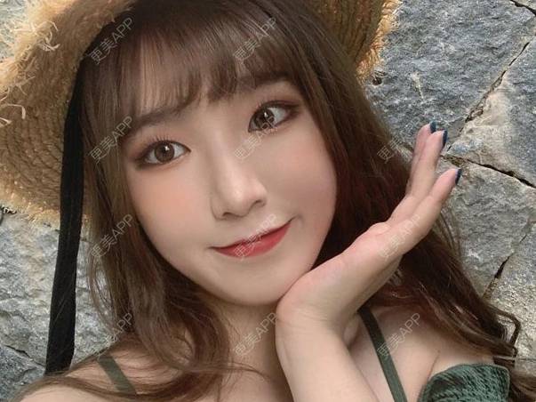 更美 - 更美用户osFPhxspG7的光子嫩肤经验 | 光子嫩肤 | 重庆