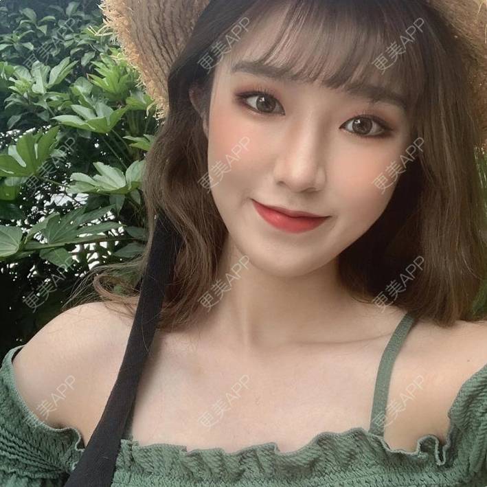 更美 - 更美用户osFPhxspG7的光子嫩肤经验 | 光子嫩肤 | 重庆