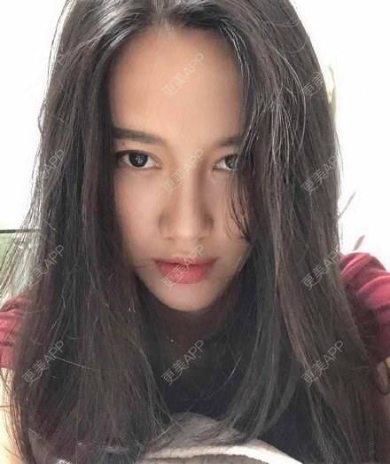 更美 - 更美用户4bynV2w0A2的鼻部多项经验 | 鼻部多项 | 武汉