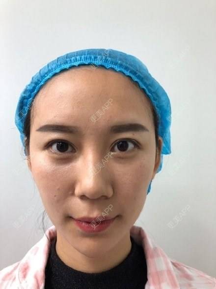 更美 - 更美用户4bynV2w0A2的鼻部多项经验 | 鼻部多项 | 武汉