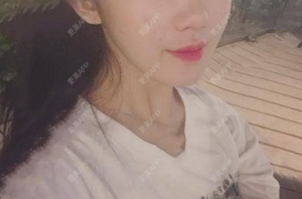 更美 - 丽丽聚说的玻尿酸下巴经验 | 更美研究所 | 注射美白 | 玻尿酸下巴 | 杭州