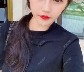 更美 - 小翘比较的除皱瘦脸经验 | 更美研究所 | 注射美白 | 杭州 | 除皱瘦脸