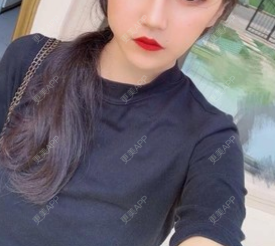 更美 - 小翘比较的除皱瘦脸经验 | 更美研究所 | 注射美白 | 杭州 | 除皱瘦脸
