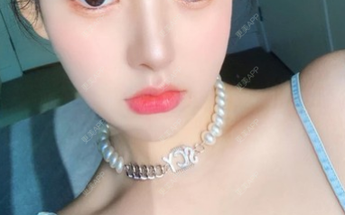 更美 - ii 就不必的玻尿酸下巴经验 | 更美研究所 | 杭州 | 玻尿酸 | 玻尿酸下巴