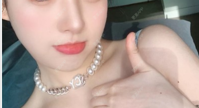 更美 - ii 就不必的玻尿酸下巴经验 | 更美研究所 | 杭州 | 玻尿酸 | 玻尿酸下巴