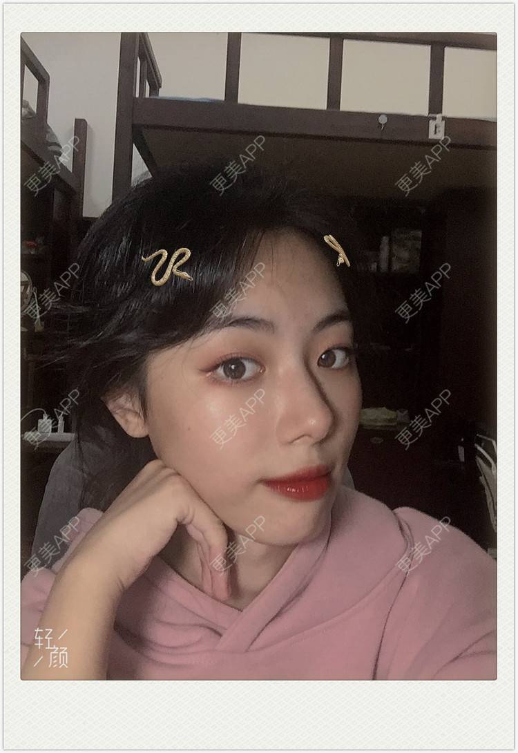 更美 - 痞子夺位先的隆鼻经验 | 隆鼻 | 无锡