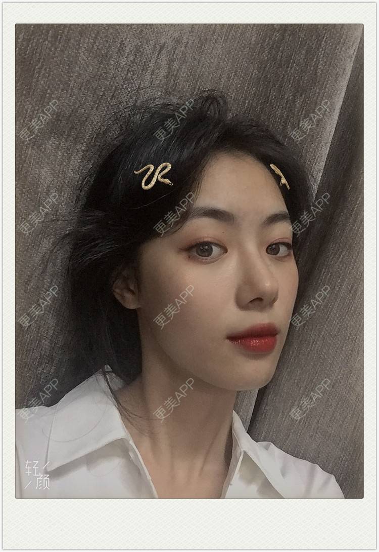 更美 - 痞子夺位先的隆鼻经验 | 隆鼻 | 无锡