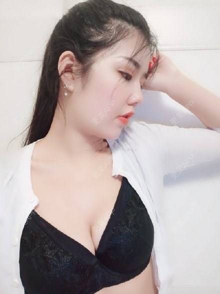 更美 - 更美用户4bynV2w0A2的假体隆胸经验 | 假体隆胸 | 武汉