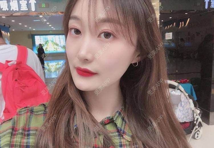 更美 - 更美用户Z3SjKafbbL的玻尿酸面颊经验 | 玻尿酸面颊