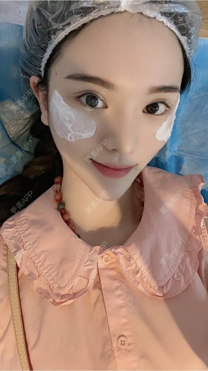 更美 - 傲娇君🌹的皮秒激光经验 | 武汉 | 皮秒激光