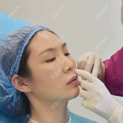 更美 - 更美用户CDt3tU9VIP的玻尿酸鼻基底经验 | 玻尿酸下巴 | 玻尿酸鼻基底 | 玻尿酸 | 重庆