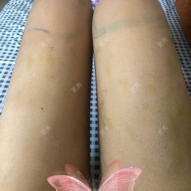 更美用户JjeRai1vC1