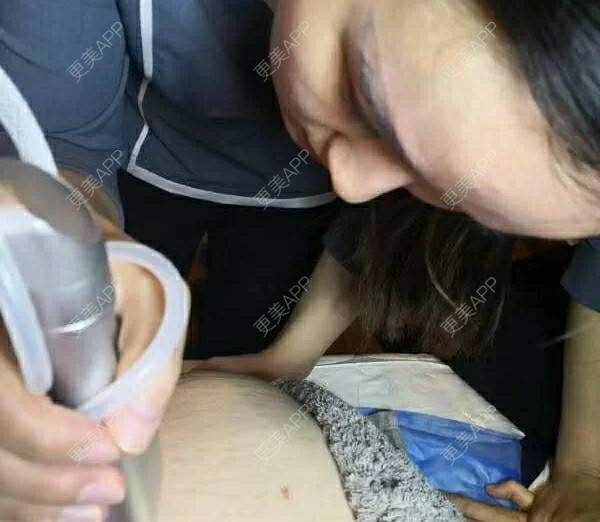 更美 - 更美用户V03UALBv6x的妊娠纹经验 | 上海 | 妊娠纹