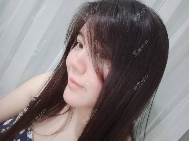 更美 - sonder.的下巴经验 | 下巴 | 硅胶垫下巴 | 长沙 | 视频日记