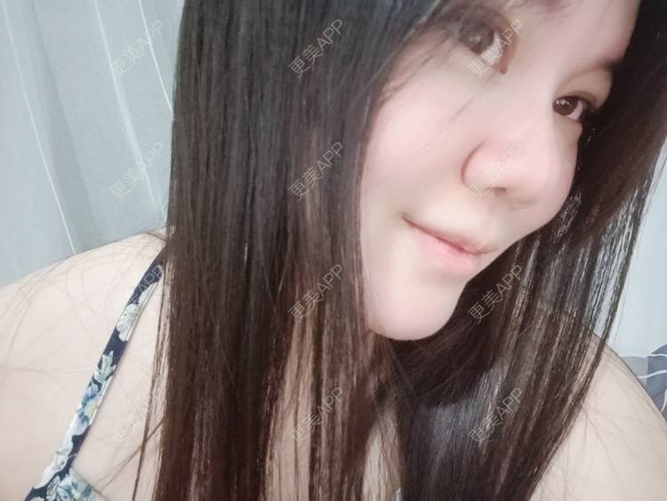 更美 - sonder.的下巴经验 | 下巴 | 硅胶垫下巴 | 长沙 | 视频日记