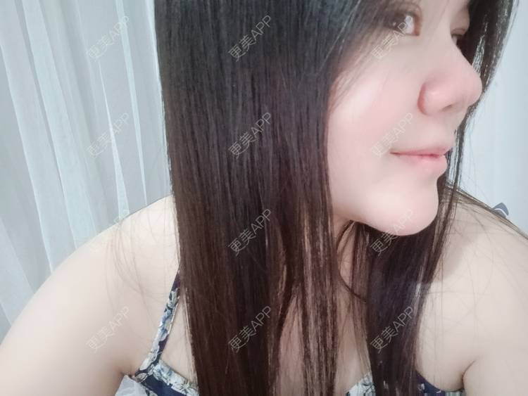 更美 - sonder.的下巴经验 | 下巴 | 硅胶垫下巴 | 长沙 | 视频日记